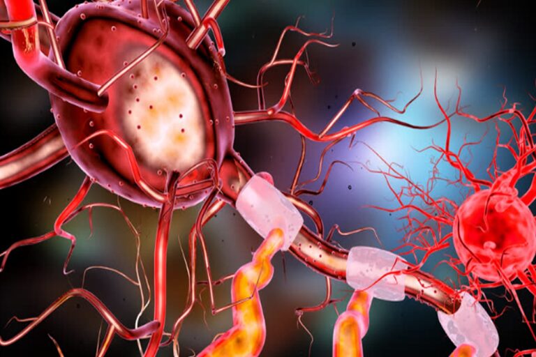 neuron, brain, human-3567980.jpg